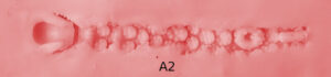 Anal texture 2