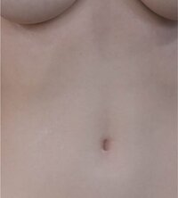 Skin Tone Fair(1)
