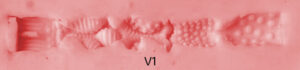 vaginal texture1