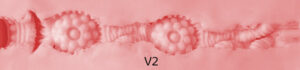 vaginal texture2