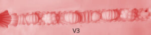 vaginal texture3