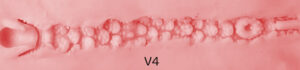 vaginal texture4